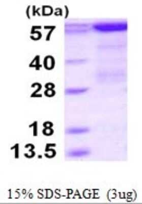 SDS-PAGE: Recombinant Human PCK1 His Protein [NBP1-78871]