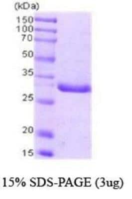 SDS-PAGE: Recombinant Human PCNA Protein [NBC1-18428]