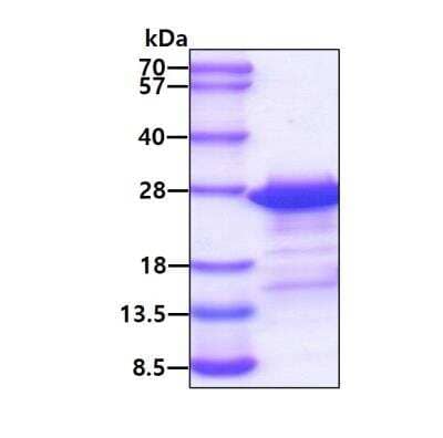 SDS-PAGE: Recombinant Human PCNP His Protein [NBP1-72415]