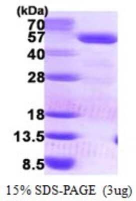 SDS-PAGE: Recombinant Human PCYT2 His Protein [NBP1-78847]