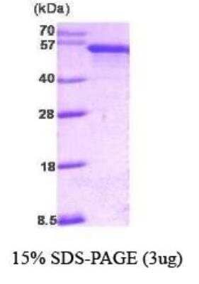 SDS-PAGE: Recombinant Human PDCD4 Protein [NBC1-18506]