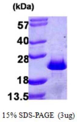 SDS-PAGE: Recombinant Human PDCD6 His Protein [NBP1-51048]