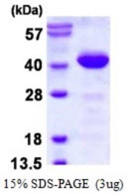 SDS-PAGE: Recombinant Human PDCL His Protein [NBP1-98927]