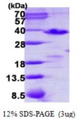 SDS-PAGE: Recombinant Human PDCL3 His Protein [NBP1-78882]