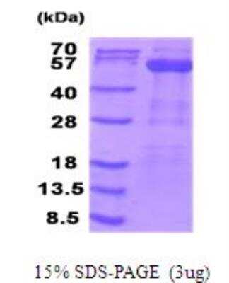 SDS-PAGE: Recombinant Human PDHX His Protein [NBP2-51944]