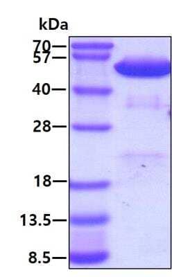 SDS-PAGE: Recombinant Human PDIA6 His Protein [NBP1-50859]