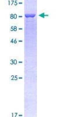 SDS-PAGE: Recombinant Human PDLIM5 GST (N-Term) Protein [H00010611-P01]