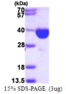 SDS-PAGE: Recombinant Human PECR His Protein [NBP1-72480]