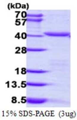 SDS-PAGE: Recombinant Human PEX19 His Protein [NBP1-72444]