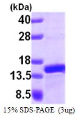 SDS-PAGE: Recombinant Human PFDN1 His Protein [NBP1-50856]