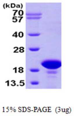 SDS-PAGE: Recombinant Human PFDN2 His Protein [NBP1-50860]