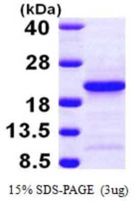 SDS-PAGE: Recombinant Human PFDN4 His Protein [NBP1-50973]