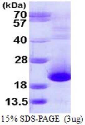 SDS-PAGE: Recombinant Human PFDN5 His Protein [NBP1-72405]