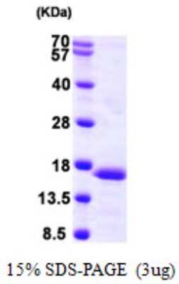 SDS-PAGE: Recombinant Human PFDN6 His Protein [NBP1-51036]