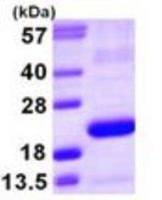 SDS-PAGE: Recombinant Human PGD2 Synthase/PTGDS His Protein [NBP1-51078]