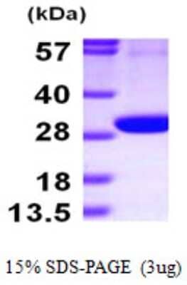 SDS-PAGE: Recombinant Human PGLS His Protein [NBP1-49446]