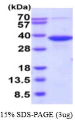 SDS-PAGE: Recombinant Human PGPase His Protein [NBP2-59585]