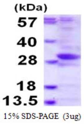 SDS-PAGE: Recombinant Human PHOSPHO2 His Protein [NBP1-78866]