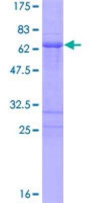 SDS-PAGE: Recombinant Human PHOX2A GST (N-Term) Protein [H00000401-P01]