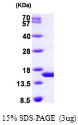 SDS-PAGE: Recombinant Human PHPT1 His Protein [NBP1-49439]