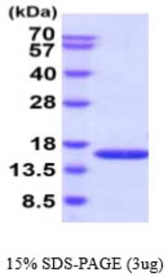 SDS-PAGE: Recombinant Human PHPT1 His Protein [NBP2-59581]