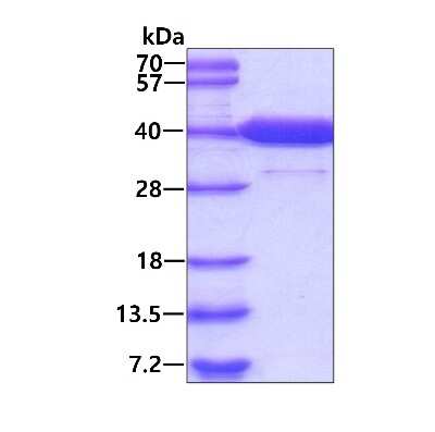 SDS-PAGE: Recombinant Human PIG3 His Protein [NBP1-44458]