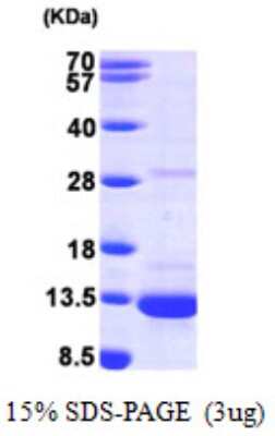 SDS-PAGE: Recombinant Human PIN/DLC8 His Protein [NBP1-49430]