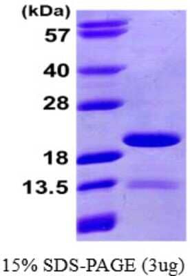 SDS-PAGE: Recombinant Human PIN4 His Protein [NBP1-51068]