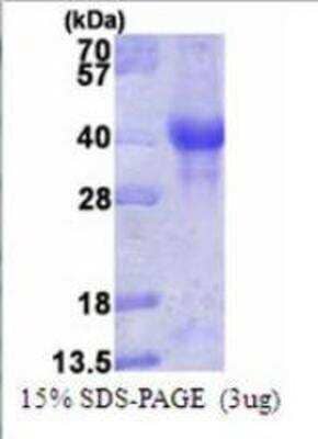 SDS-PAGE: Recombinant Human PINK1 Protein [NBP1-72481]