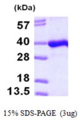 SDS-PAGE: Recombinant Human PITPNB His Protein [NBP1-50864]