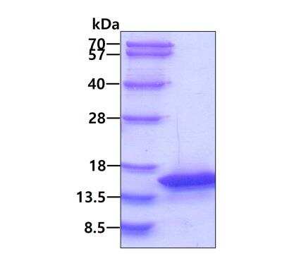 SDS-PAGE: Recombinant Human PKI-beta His Protein [NBP1-51058]