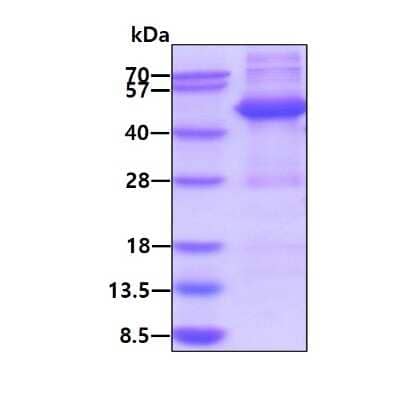 SDS-PAGE: Recombinant Human PLA2G7/PAF-AH/Lp-PLA2 His Protein [NBP2-51918]