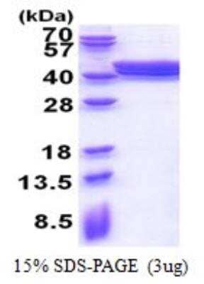 SDS-PAGE: Recombinant Human PLEKHF2 His Protein [NBP2-51582]