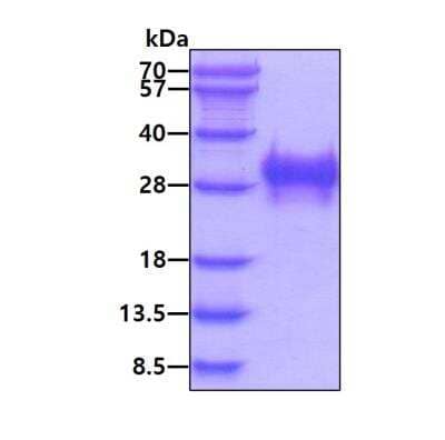 SDS-PAGE: Recombinant Human PLGF His Protein [NBP3-11847]