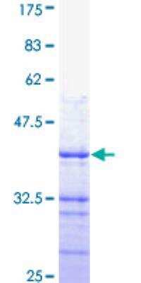 SDS-PAGE: Recombinant Human PMCA4 GST (N-Term) Protein [H00000493-Q01]