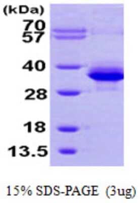 SDS-PAGE: Recombinant Human PMM1/Phosphomannomutase 1 His Protein [NBP1-50868]