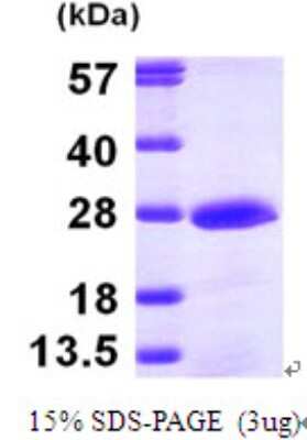 SDS-PAGE: Recombinant Human PMVK/phosphomevalonate kinase His Protein [NBP1-49168]