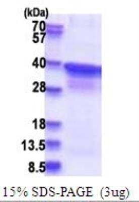 SDS-PAGE: Recombinant Human POLR2C His Protein [NBP2-51736]