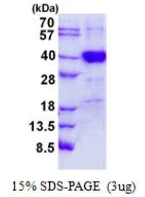 SDS-PAGE: Recombinant Human POLR3F His Protein [NBP2-23350]