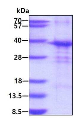 SDS-PAGE: Recombinant Human POMC His Protein [NBP1-72334]