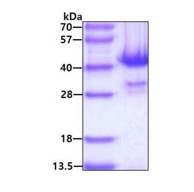 SDS-PAGE: Recombinant Human PP1 alpha/PPP1A His Protein [NBP1-72418]