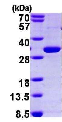 SDS-PAGE: Recombinant Human PPAR gamma/NR1C3 His Protein [NBP1-45290]