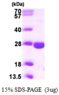 SDS-PAGE: Recombinant Human PPCDC His Protein [NBP1-49436]