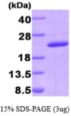 SDS-PAGE: Recombinant Human PPIG His Protein [NBP1-50830]