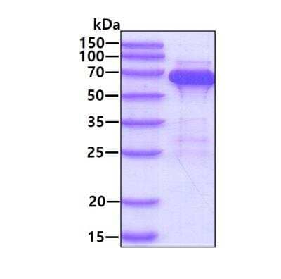 SDS-PAGE: Recombinant Human PPIL2 His Protein [NBP1-41225]