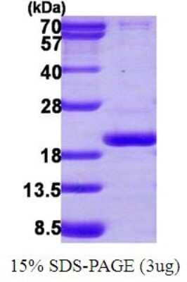 SDS-PAGE: Recombinant Human PPIL3 His Protein [NBP1-72472]