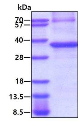 SDS-PAGE: Recombinant Human PPM1D His Protein [NBP2-51998]