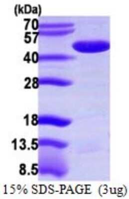 SDS-PAGE: Recombinant Human PPME1 His Protein [NBP1-72395]