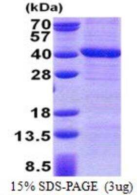 SDS-PAGE: Recombinant Human PP4/PPP4C His Protein [NBP2-23383]