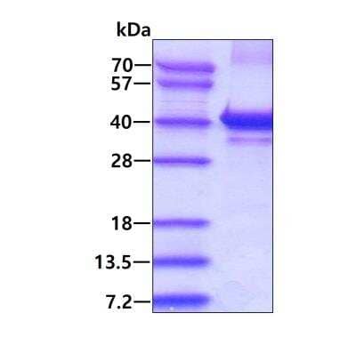 SDS-PAGE: Recombinant Human PQBP1 His Protein [NBP1-98987]